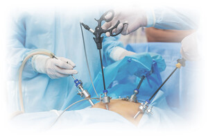 Better Insight for Surgeons